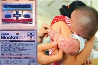 Thực hư vòng đeo tay có khả năng phòng chống bệnh sởi